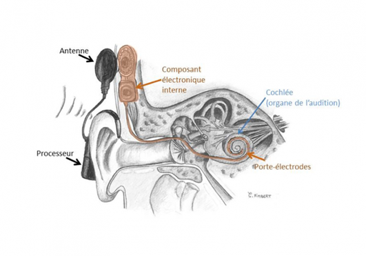 Le schéma de l'oreille interne est expliqué dans la légende
