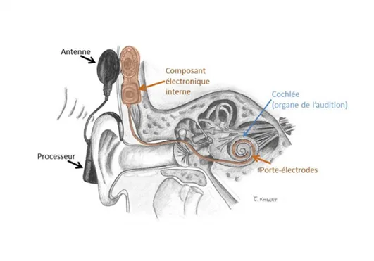 Le schéma de l'oreille interne est expliqué dans la légende