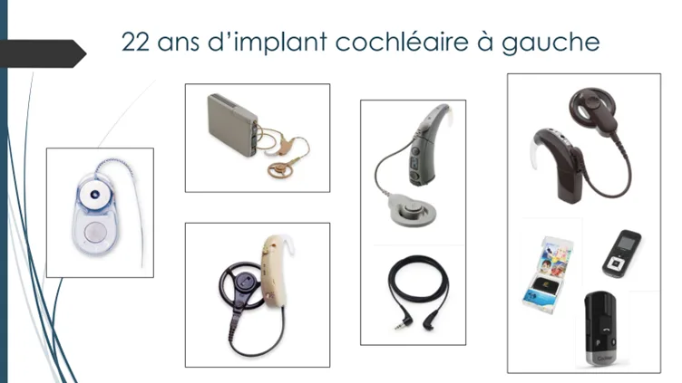 Le slide est décrite dans la légende